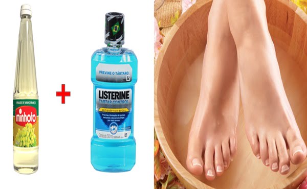 Listerine e Vinagre para os Pés Rachados – Como Usar ? Listerine é bom para o pé ?