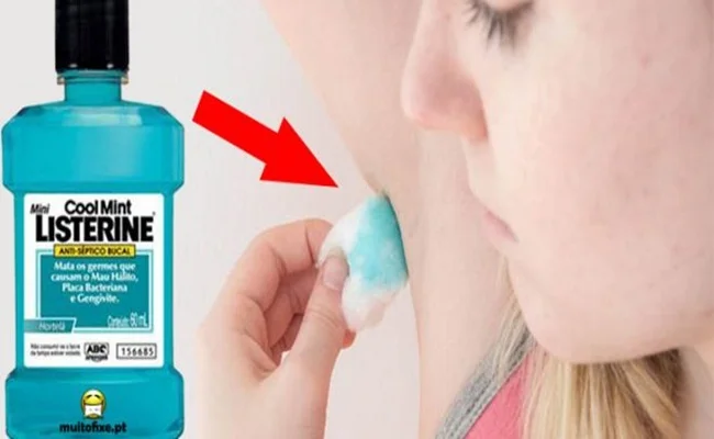 UTILIDADES MILAGROSAS do LISTERINE que VOCÊ PRECISA SABER