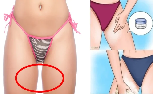COMO CLAREAR MANCHAS ESCURAS ENTRE AS COXAS - Receita Caseira Poderosa