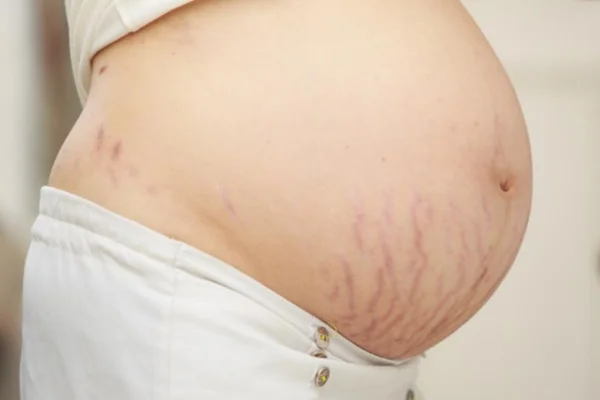 CUIDADOS COM o CORPO NA GRAVIDEZ