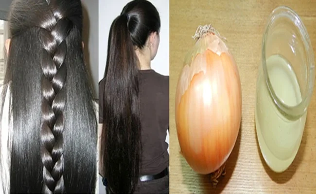 CEBOLA FAZ O CABELO CRESCER - VERDADE ou MITO?
