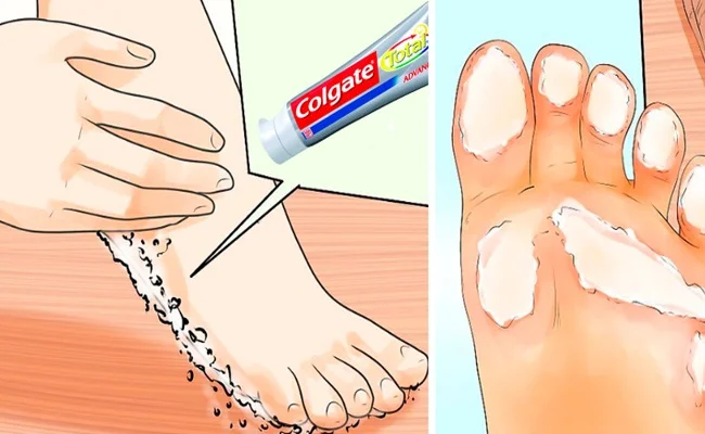 CREME DENTAL nos PÉS para QUE SERVE? COMO USAR?