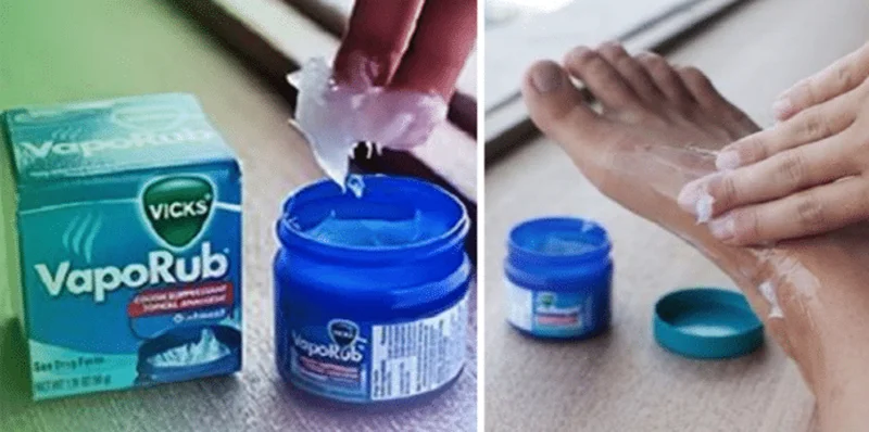 Utilidades do Vick Vaporub - 10 Utilidades que você Não Sabia