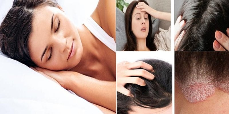 Dormir com o cabelo molhado faz mal? Descubra porque você nunca deve fazer isso.